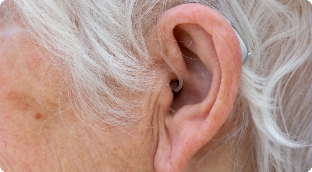 does-medicare-cover-hearing-aides